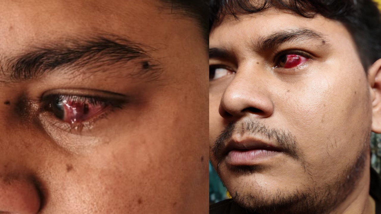 জলঢাকায় চাঁদা না দেওয়ায় মোবাইল ব্যবসায়ীকে মারধর ও টাকা লুট